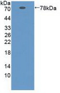 Polyclonal Antibody to Serpin A10 (SERPINA10)