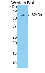 Polyclonal Antibody to Complement Factor B (CFB)