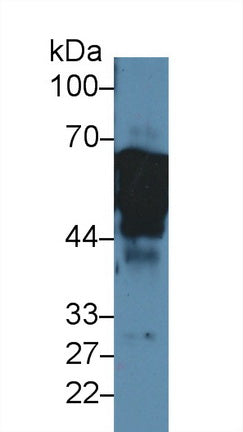 Polyclonal Antibody to Cytokeratin 8 (CK8)