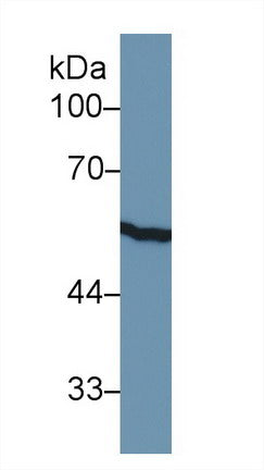 Polyclonal Antibody to Cytokeratin 8 (CK8)