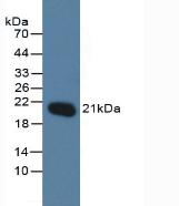 Polyclonal Antibody to O-6-Methylguanine DNA Methyltransferase (MGMT)