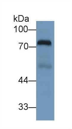 Polyclonal Antibody to Transferrin (TF)