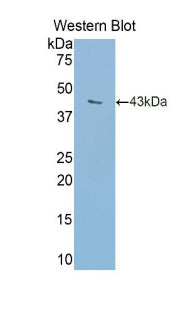 Polyclonal Antibody to Transferrin (TF)