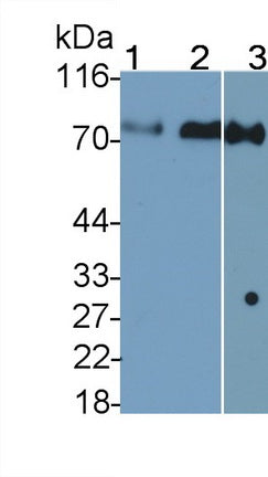 Polyclonal Antibody to Transferrin (TF)