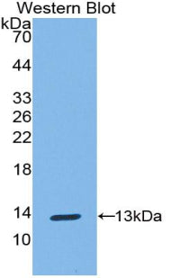 Polyclonal Antibody to S100 Calcium Binding Protein A10 (S100A10)