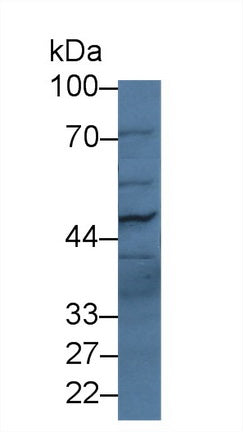 Polyclonal Antibody to Phospholipase B (PLB)