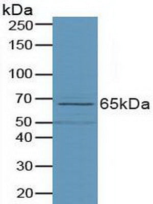 Polyclonal Antibody to Phospholipase D (PLD)