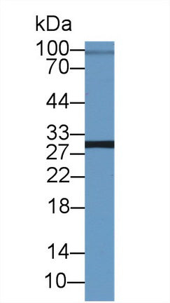 Polyclonal Antibody to Asialoglycoprotein Receptor 2 (ASGR2)