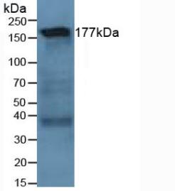 Polyclonal Antibody to Laminin Gamma 1 (LAMC1)