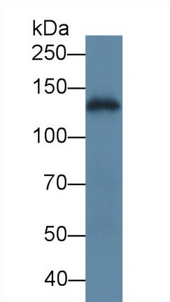 Polyclonal Antibody to Laminin Gamma 2 (LAMC2)