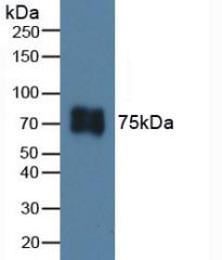 Polyclonal Antibody to Integrin Beta 6 (ITGb6)