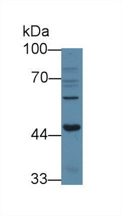 Polyclonal Antibody to Activin A Receptor Type I B (ACVR1B)