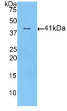 Polyclonal Antibody to Activin A Receptor Type II A (ACVR2A)