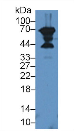 Polyclonal Antibody to Decorin (DCN)