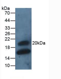 Polyclonal Antibody to Gremlin 1 (GREM1)