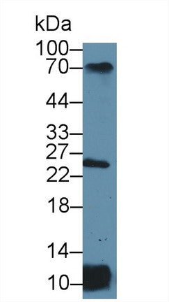Polyclonal Antibody to HLA Class II Histocompatibility Antigen, DR Alpha Chain (HLA-DRA)