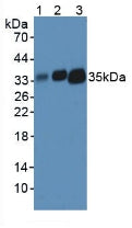 Polyclonal Antibody to HLA Class II Histocompatibility Antigen, DR Alpha Chain (HLA-DRA)