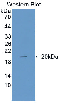 Polyclonal Antibody to Glia Maturation Factor Beta (GMFb)