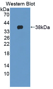 Polyclonal Antibody to Neurocan (NCAN)
