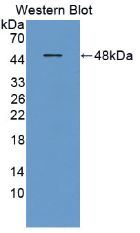 Polyclonal Antibody to Neurotrophic Tyrosine Kinase Receptor Type 3 (NTRK3)
