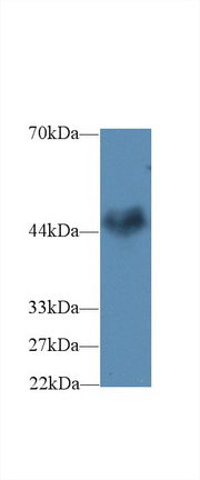 Polyclonal Antibody to Ciliary Neurotrophic Factor Receptor (CNTFR)