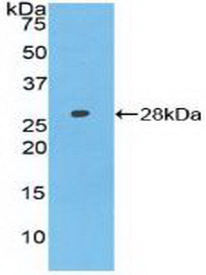 Polyclonal Antibody to Axis Inhibition Protein (AXIN)