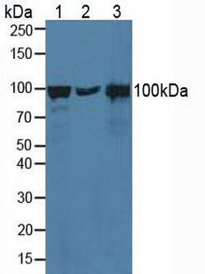 Polyclonal Antibody to Catenin Alpha 1 (CTNNa1)