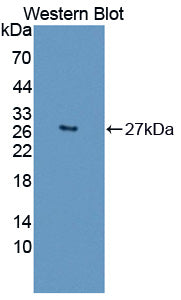 Polyclonal Antibody to Desmoplakin (DSP)