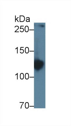 Polyclonal Antibody to Amphiphysin (AMPH)