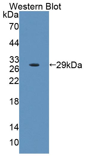 Polyclonal Antibody to Host Cell Factor C1 (HCFC1)