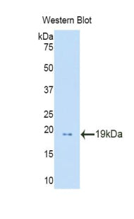 Polyclonal Antibody to Profilin 1 (PFN1)