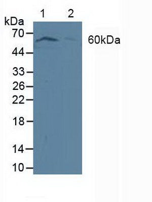 Polyclonal Antibody to Phosphoinositide Dependent Protein Kinase 1 (PDPK1)