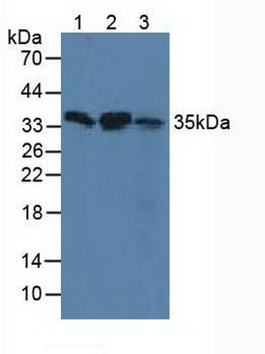 Polyclonal Antibody to Survival Motor Neuron Protein (SMN)