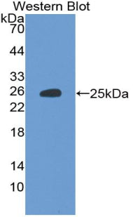 Polyclonal Antibody to Tight Junction Protein 1 (TJP1)