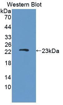 Polyclonal Antibody to Disrupted In Schizophrenia 1 (DISC1)
