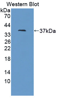 Polyclonal Antibody to Ionized Calcium-binding Adapter Molecule 1 (IBA1)