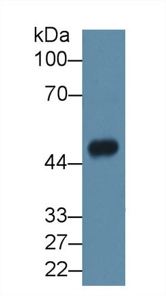 Polyclonal Antibody to N-Acylsphingosine Amidohydrolase 1 (ASAH1)