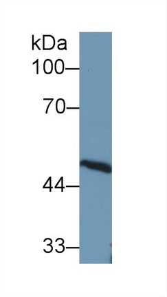 Polyclonal Antibody to Antithrombin (AT)