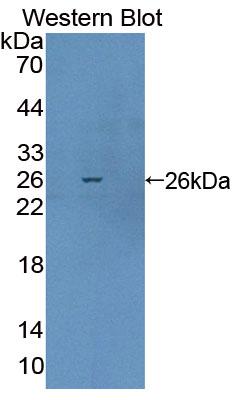 Polyclonal Antibody to Aristaless Related Homeobox Protein (ARX)