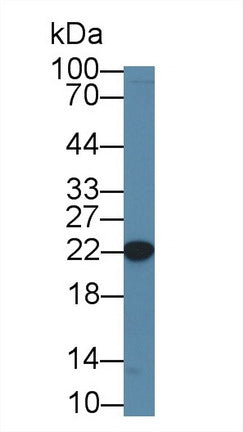 Polyclonal Antibody to Core Binding Factor Beta Subunit (CBFb)