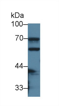 Polyclonal Antibody to Carboxylesterase 1 (CES1)