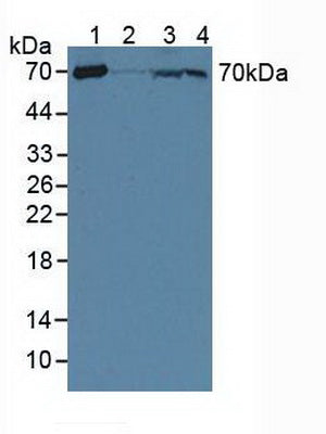 Polyclonal Antibody to Carnitine Acetyltransferase (CRAT)