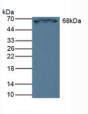 Polyclonal Antibody to Carnitine Acetyltransferase (CRAT)