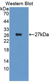 Polyclonal Antibody to Carnitine-O-Octanoyltransferase (CORT)