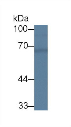 Polyclonal Antibody to Chimerin 2 (CHN2)