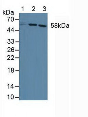 Polyclonal Antibody to Dyskerin (DKC)