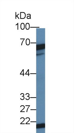 Polyclonal Antibody to Dyskerin (DKC)