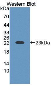 Polyclonal Antibody to Epithelial Cell Transforming Sequence 2 (ECT2)