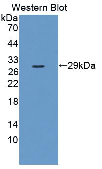 Polyclonal Antibody to Fibrosin (FBS)