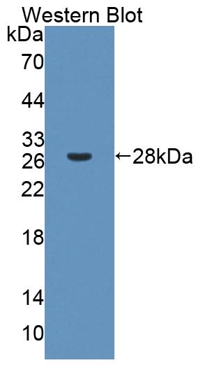 Polyclonal Antibody to Flavin Containing Monooxygenase 2, Non Functional (FMO2)
